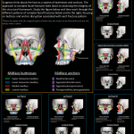 Complex facial fracture classification, including Le Fort I, II, and III. Full size image at: bit.ly/leforts
