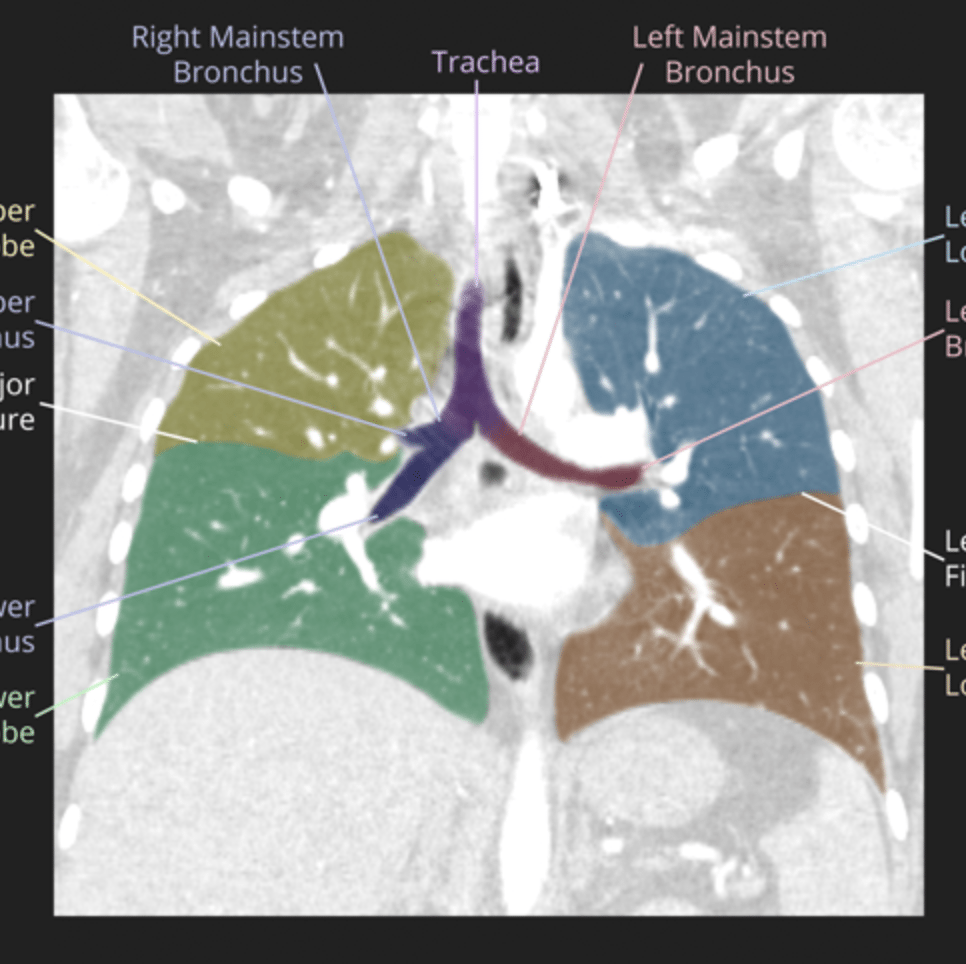 Chest CT Anatomy