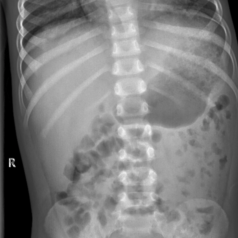 Casestacks Com Radiology Case Case 24 Casestacks Com Radiology Case Case 24