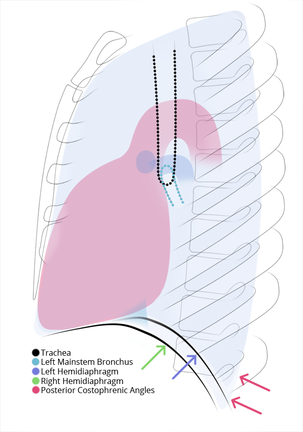 Chest XRay Anatomy