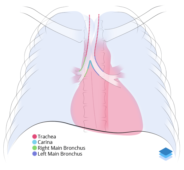 Chest XRay Anatomy