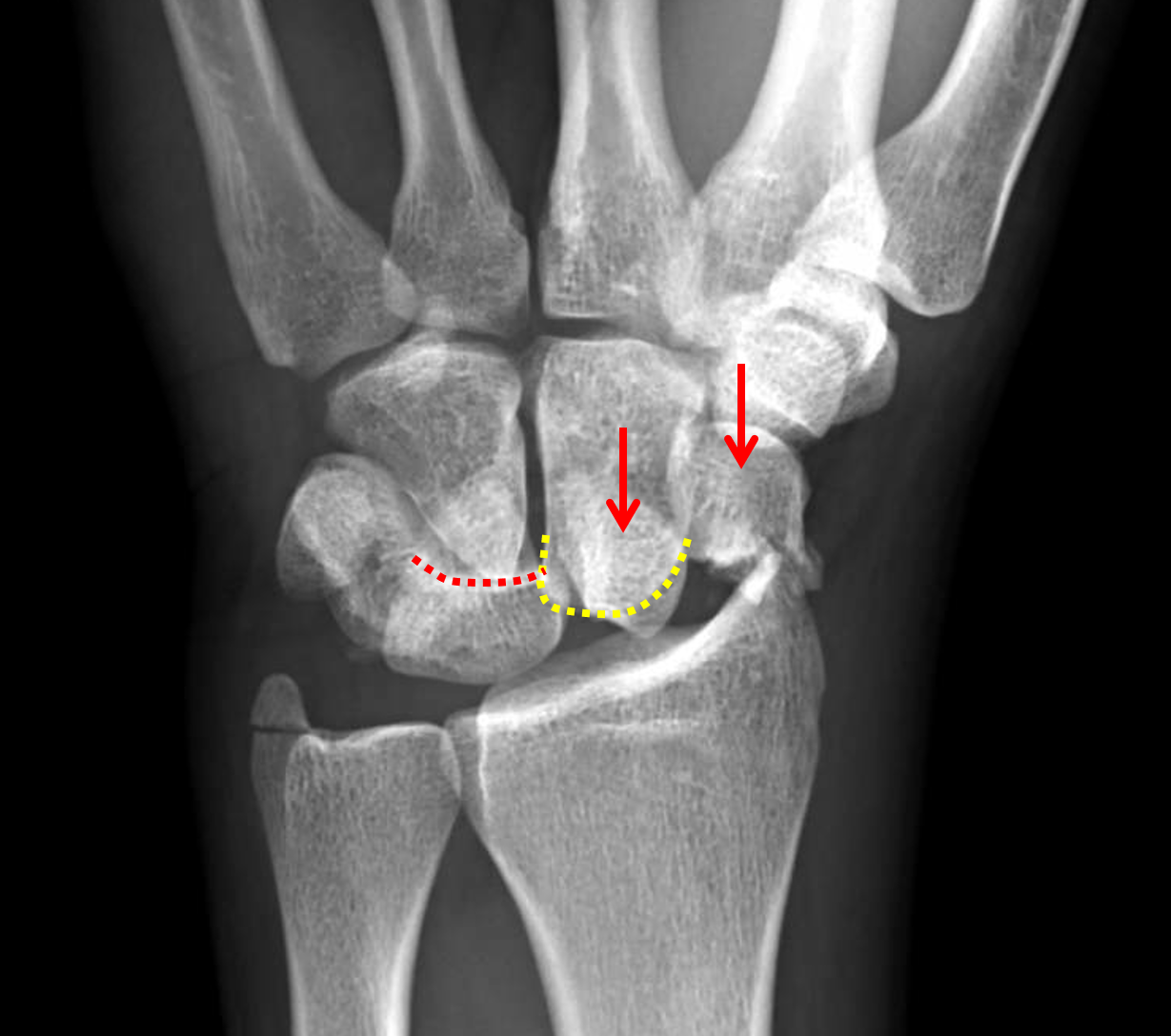 CaseStacks.com - MSK Radiograph Case #15