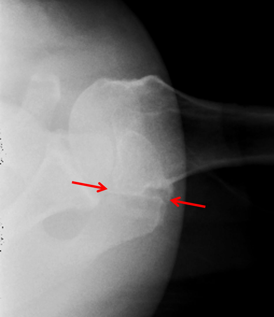 CaseStacks com MSK Radiograph Case 7