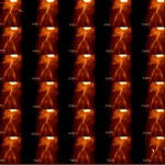 Splash composition of post flow imaging demonstrates the early presence of the double-barreled appearance of the pelvic vasculature which does not change over time (blue arrows). Free pertechnetate in the stomach (gray arrow) and urinary bladder (yellow arrow).