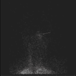 Angiographic phase shows increased activity in the region of the nose (red arrow), known as the hot nose sign.
