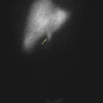 Imaging at 4 minutes shows clearance of radiotracer from the blood pool, uniform hepatic uptake, and small amount of activity within the extrahepatic biliary tree (green arrow).