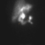 Imaging at 32 minutes shows bowel activity (brown arrows).