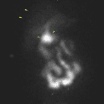 Delayed imaging after morphine administration with still no radiotracer seen within the gallbladder. There is continued clearance of activity from the liver parenchyma (yellow arrows), and distal transit of the activity within the bowel (brown arrows). Green arrows show a more concentrated collection of radiotracer activity in the region of the distal common bile duct and duodenal bulb, of unclear significance.