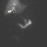 Expected filling of the gallbladder (orange arrows), CBD activity (green arrows), and bowel lumen activity (brown arrows), all seen before 60 minutes.