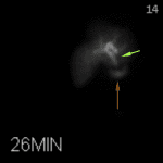 Expected activity in the biliary tree (green arrow) and the duodenum (brown arrow) before 30 minutes.