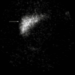 24 hour image shows persistent hepatic activity (yellow arrow) without any biliary or bowel activity. Trace amount of activity in the region of the urinary bladder.