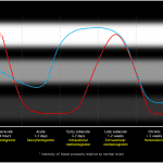 Evolution of parenchymal hematoma T1 and T2 signal over time.