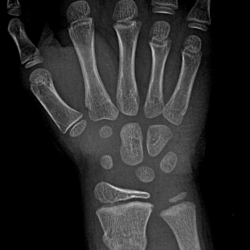 CaseStacks.com — Interactive Pediatric Wrist & Hand Radiograph Cases