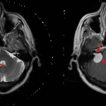 Red arrows show the location of the mass on each sequence.