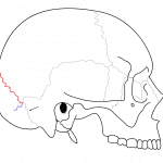 Typical location of the mendosal suture (blue) in relation to the lambdoid suture (red) and the occipitomastoid suture (black arrow). Illustration modified from original by I, RosarioVanTulpe / CC BY-SA (http://creativecommons.org/licenses/by-sa/3.0/) via WikiMedia (https://commons.wikimedia.org/wiki/File:Lambdoid_suture.png)