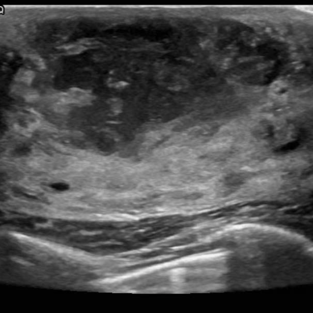 CaseStacks.com - Ultrasound Case #15